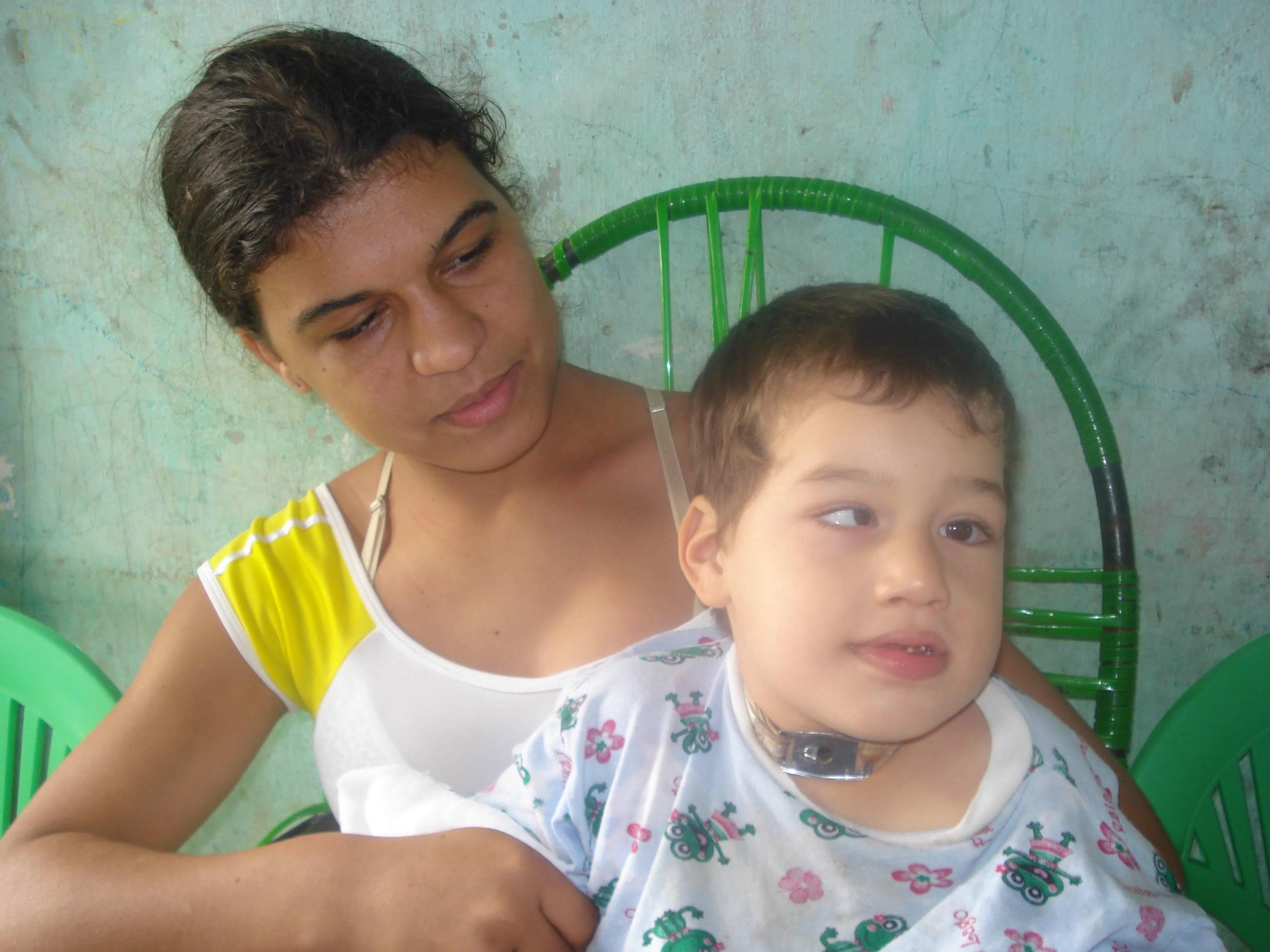 Descaso: Criança com Paralisia Cerebral é abandonada pelo poder Público de Gararu